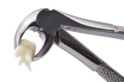 TOOTH EXTRACTION