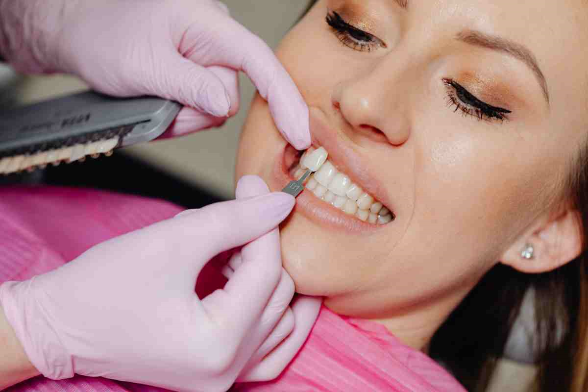 VENEERS